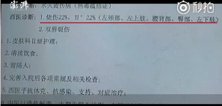刘维新歌《美味超能力》 不用freestyle 一样让你心跳‘足球新闻’(图2) 意大利足球